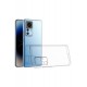 Newface Xiaomi Mi 12T Kılıf Lüx Şeffaf Silikon Newface Xiaomi Mi 12T Kılıf Lüx Şeffaf Silikon