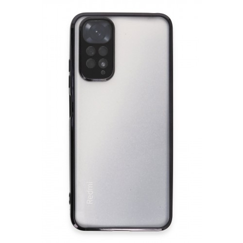 Newface Xiaomi Redmi Note 11S Kılıf Razer Lensli Silikon - Siyah