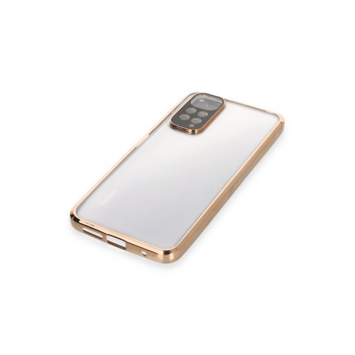 Newface Xiaomi Redmi Note 11S Kılıf Razer Lensli Silikon - Gold Newface Xiaomi Redmi Note 11S Kılıf Razer Lensli Silikon - Gold