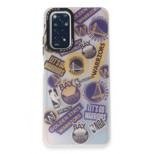 Newface Xiaomi Redmi Note 11 Kılıf Estoril Desenli Kapak - Estoril - 13 Newface Xiaomi Redmi Note 11 Kılıf Estoril Desenli Kapak - Estoril - 13