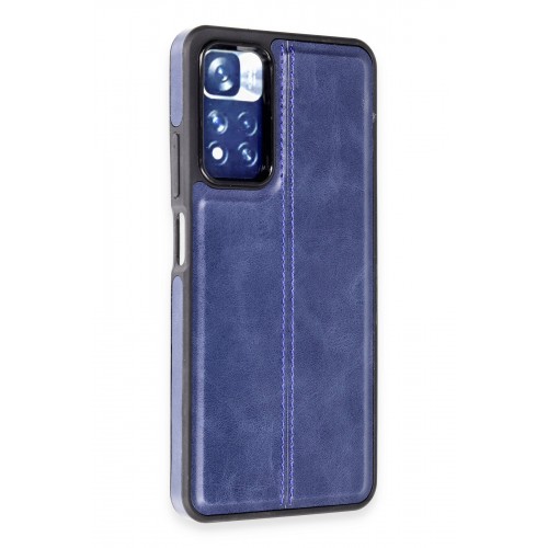 Newface Xiaomi Redmi Note 11 Pro Kılıf Ozzi Kapak - Lacivert Newface Xiaomi Redmi Note 11 Pro Kılıf Ozzi Kapak - Lacivert