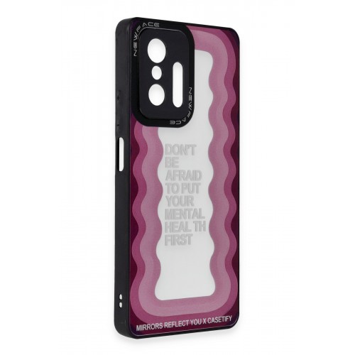 Newface Xiaomi Mi 11T Pro Kılıf Mirror Desenli Kapak - Mirror - 11 Newface Xiaomi Mi 11T Pro Kılıf Mirror Desenli Kapak - Mirror - 11