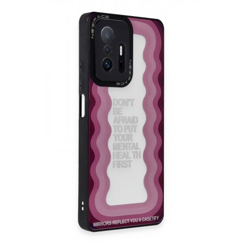 Newface Xiaomi Mi 11T Pro Kılıf Mirror Desenli Kapak - Mirror - 11 Newface Xiaomi Mi 11T Pro Kılıf Mirror Desenli Kapak - Mirror - 11