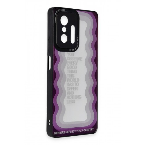 Newface Xiaomi Mi 11T Kılıf Mirror Desenli Kapak - Mirror - 5 Newface Xiaomi Mi 11T Kılıf Mirror Desenli Kapak - Mirror - 5