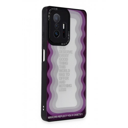 Newface Xiaomi Mi 11T Kılıf Mirror Desenli Kapak - Mirror - 5 Newface Xiaomi Mi 11T Kılıf Mirror Desenli Kapak - Mirror - 5
