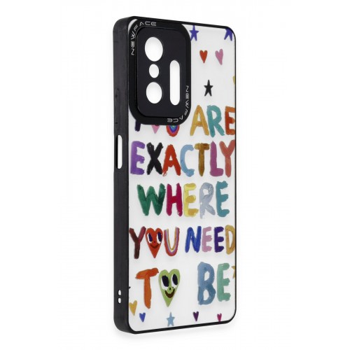Newface Xiaomi Mi 11T Pro Kılıf Mirror Desenli Kapak - Mirror - 10 Newface Xiaomi Mi 11T Pro Kılıf Mirror Desenli Kapak - Mirror - 10