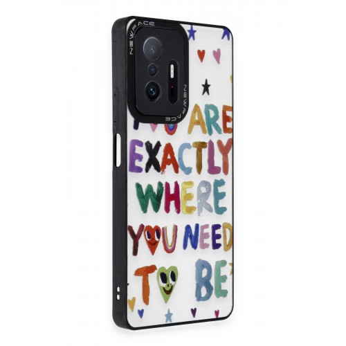 Newface Xiaomi Mi 11T Pro Kılıf Mirror Desenli Kapak - Mirror - 10 Newface Xiaomi Mi 11T Pro Kılıf Mirror Desenli Kapak - Mirror - 10