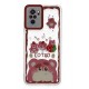 Newface Xiaomi Redmi Note 10 Pro Kılıf Sweet Desenli Silikon Kapak - Pembe