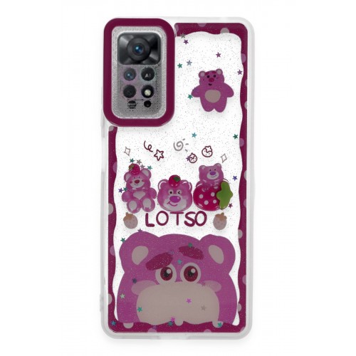 Newface Xiaomi Redmi Note 11S Kılıf Sweet Desenli Silikon Kapak - Pembe Newface Xiaomi Redmi Note 11S Kılıf Sweet Desenli Silikon Kapak - Pembe