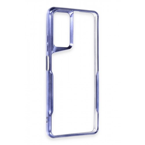 Newface Xiaomi Redmi Note 12 Pro 4G Kılıf Boyi Silikon Kapak - Lacivert Newface Xiaomi Redmi Note 12 Pro 4G Kılıf Boyi Silikon Kapak - Lacivert