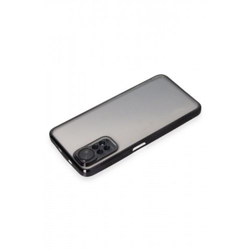Newface Xiaomi Redmi Note 11 4G Kılıf Razer Lensli Silikon - Siyah Newface Xiaomi Redmi Note 11 4G Kılıf Razer Lensli Silikon - Siyah