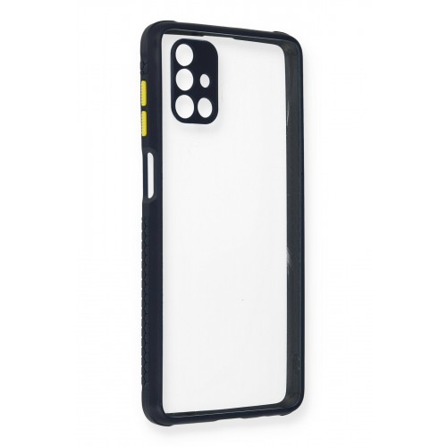 Newface Samsung Galaxy M51 Kılıf Miami Şeffaf Silikon - Lacivert Newface Samsung Galaxy M51 Kılıf Miami Şeffaf Silikon - Lacivert