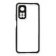 Newface Xiaomi Mi 10T Kılıf Miami Şeffaf Silikon - Siyah Newface Xiaomi Mi 10T Kılıf Miami Şeffaf Silikon - Siyah