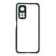 Newface Xiaomi Mi 10T Pro Kılıf Miami Şeffaf Silikon - Koyu Yeşil Newface Xiaomi Mi 10T Pro Kılıf Miami Şeffaf Silikon - Koyu Yeşil