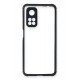 Newface Xiaomi Mi 10T Pro Kılıf Miami Şeffaf Silikon - Lacivert Newface Xiaomi Mi 10T Pro Kılıf Miami Şeffaf Silikon - Lacivert