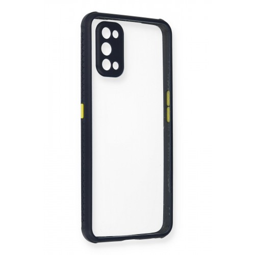 Newface Realme 7 Pro Kılıf Miami Şeffaf Silikon - Lacivert Newface Realme 7 Pro Kılıf Miami Şeffaf Silikon - Lacivert