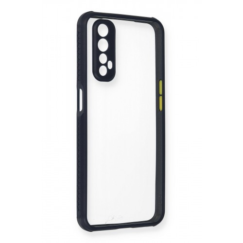 Newface Realme 7 Kılıf Miami Şeffaf Silikon  - Lacivert