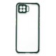 Newface Oppo A73 Kılıf Miami Şeffaf Silikon - Koyu Yeşil Newface Oppo A73 Kılıf Miami Şeffaf Silikon - Koyu Yeşil