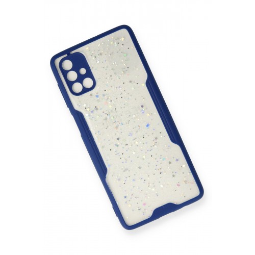 Newface Samsung Galaxy M51 Kılıf Platin Simli Silikon - Lacivert Newface Samsung Galaxy M51 Kılıf Platin Simli Silikon - Lacivert