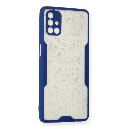 Newface Samsung Galaxy M51 Kılıf Platin Simli Silikon - Lacivert Newface Samsung Galaxy M51 Kılıf Platin Simli Silikon - Lacivert