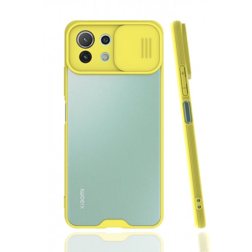 Newface Xiaomi Mİ 11 Lite Kılıf Platin Kamera Koruma Silikon - Sarı Newface Xiaomi Mİ 11 Lite Kılıf Platin Kamera Koruma Silikon - Sarı