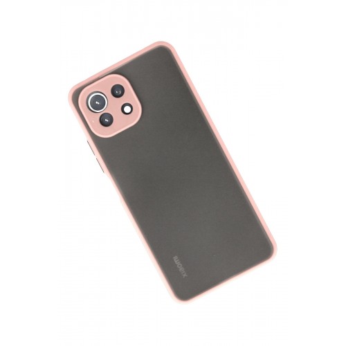Newface Xiaomi Mİ 11 Lite Kılıf Montreal Silikon Kapak - Pembe Newface Xiaomi Mİ 11 Lite Kılıf Montreal Silikon Kapak - Pembe