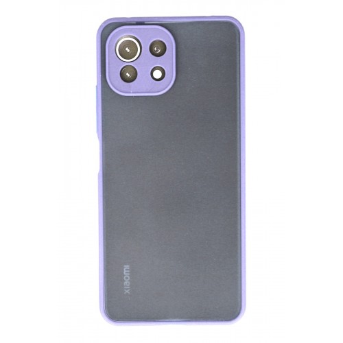 Newface Xiaomi Mİ 11 Lite Kılıf Montreal Silikon Kapak - Mor Newface Xiaomi Mİ 11 Lite Kılıf Montreal Silikon Kapak - Mor