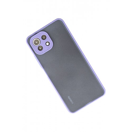 Newface Xiaomi Mİ 11 Lite Kılıf Montreal Silikon Kapak - Mor Newface Xiaomi Mİ 11 Lite Kılıf Montreal Silikon Kapak - Mor