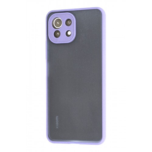 Newface Xiaomi Mİ 11 Lite Kılıf Montreal Silikon Kapak - Mor Newface Xiaomi Mİ 11 Lite Kılıf Montreal Silikon Kapak - Mor