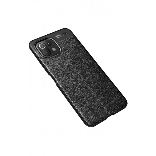 Newface Xiaomi Mİ 11 Lite Kılıf Focus Derili Silikon - Siyah Newface Xiaomi Mİ 11 Lite Kılıf Focus Derili Silikon - Siyah