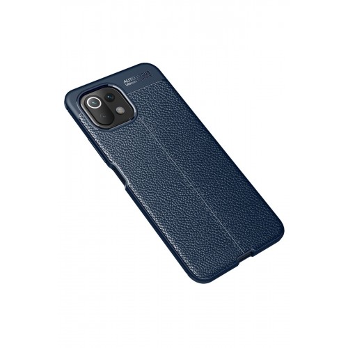 Newface Xiaomi Mİ 11 Lite Kılıf Focus Derili Silikon - Lacivert Newface Xiaomi Mİ 11 Lite Kılıf Focus Derili Silikon - Lacivert