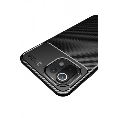 Newface Xiaomi Mİ 11 Lite Kılıf Focus Karbon Silikon - Siyah Newface Xiaomi Mİ 11 Lite Kılıf Focus Karbon Silikon - Siyah