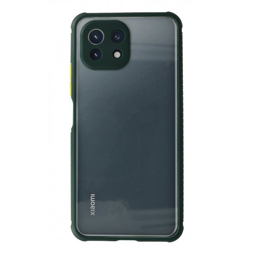 Newface Xiaomi Mİ 11 Lite Kılıf Miami Şeffaf Silikon - Koyu Yeşil Newface Xiaomi Mİ 11 Lite Kılıf Miami Şeffaf Silikon - Koyu Yeşil