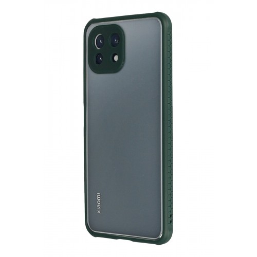 Newface Xiaomi Mİ 11 Lite Kılıf Miami Şeffaf Silikon - Koyu Yeşil Newface Xiaomi Mİ 11 Lite Kılıf Miami Şeffaf Silikon - Koyu Yeşil