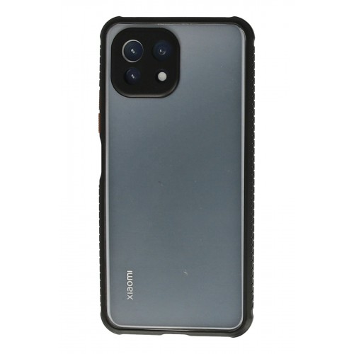 Newface Xiaomi Mİ 11 Lite Kılıf Miami Şeffaf Silikon - Siyah Newface Xiaomi Mİ 11 Lite Kılıf Miami Şeffaf Silikon - Siyah