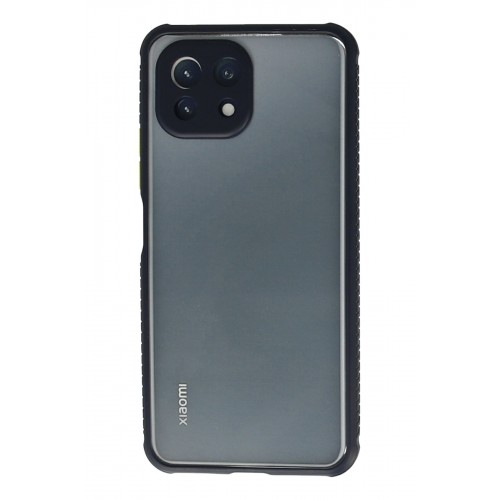 Newface Xiaomi Mİ 11 Lite Kılıf Miami Şeffaf Silikon - Lacivert Newface Xiaomi Mİ 11 Lite Kılıf Miami Şeffaf Silikon - Lacivert