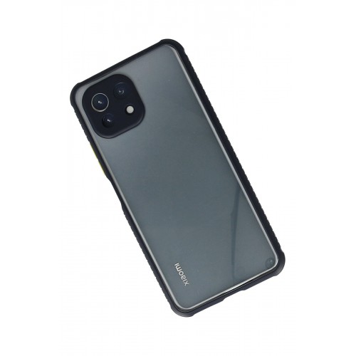 Newface Xiaomi Mİ 11 Lite Kılıf Miami Şeffaf Silikon - Lacivert Newface Xiaomi Mİ 11 Lite Kılıf Miami Şeffaf Silikon - Lacivert