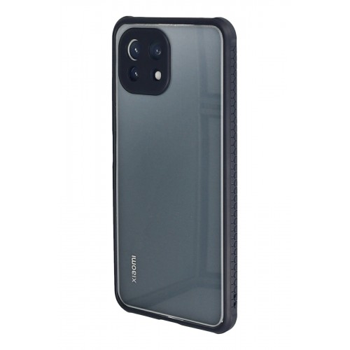 Newface Xiaomi Mİ 11 Lite Kılıf Miami Şeffaf Silikon - Lacivert Newface Xiaomi Mİ 11 Lite Kılıf Miami Şeffaf Silikon - Lacivert