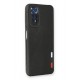 Newface Xiaomi Redmi Note 11 Kılıf Loop Deri Silikon - Siyah Newface Xiaomi Redmi Note 11 Kılıf Loop Deri Silikon - Siyah
